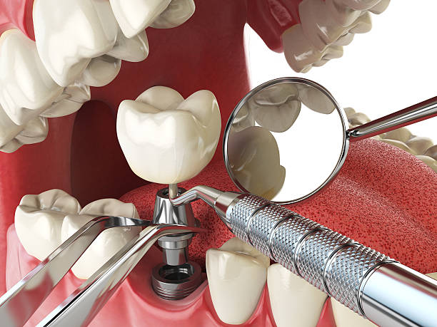 Best Cracked Tooth Emergency Dentist  in Ackerman, MS